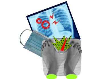 Діагноз за 2,5 години. Що змінилося у лікуванні туберкульозу в Україні
